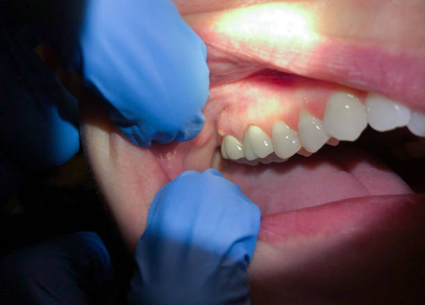 Best Emergency Dental Services for Seniors in Shamrock, TX